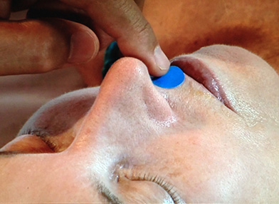 Woman receiving acupressure treatment.