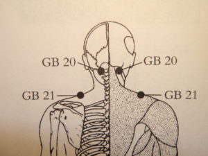  Neck Tension image 