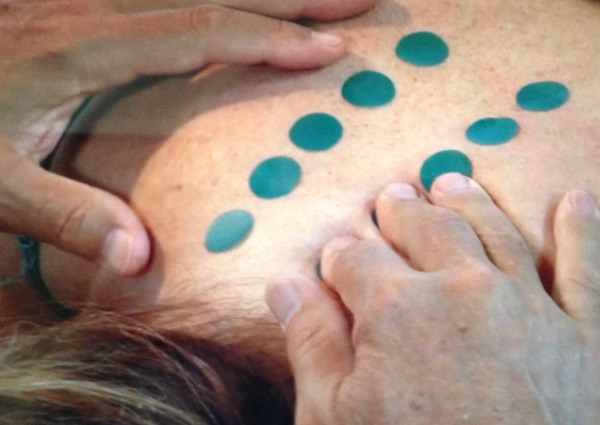 Demonstration of acupressure points on cervical spine.