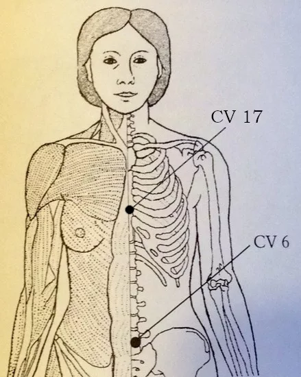  Acupressure chart of CV 6 and CV 17 